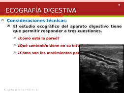9
Consideraciones técnicas:
El estudio ecográfico del aparato digestivo tiene 
que permitir responder a tres cuestiones.
¿