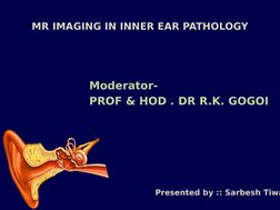 MR IMAGING IN INNER EAR PATHOLOGY
Moderator-
PROF & HOD . DR R.K. GOGOI 
Presented by :: Sarbesh Tiwa

