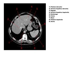 1) Pulmón derecho 
2) Arteria hepática derecha 
3) Hígado 
4) Arteria hepatica izquierda 
5) Estómago 
6) Colon 
7) Bazo 
8)