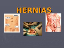 (http://images.google.com.pe/imgres?imgurl=http://www.cirugest.com/revista/2003-03-26/figura07.jpg&imgrefurl=http://www.ciru