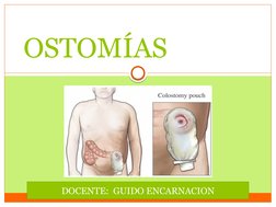 OSTOMÍAS 
DOCENTE:  GUIDO ENCARNACION
