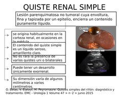 QUISTE RENAL SIMPLE
Lesión parenquimatosa no tumoral cuya envoltura, 
fina y tapizada por un epitelio, encierra un contenido