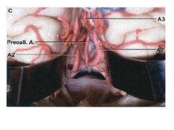 Rhoton Cranial Anatomy and Surgical Approach 2 | PDF