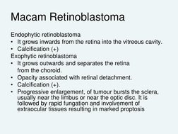 Macam Retinoblastoma
Endophytic retinoblastoma 
• It grows inwards from the retina into the vitreous cavity.
• Calcification