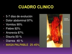 5-7 dias de evolución
Dolor abdominal 97% 
Vomitos 90%
Fiebre 82%
Anorexia 87%
Disuria 50 %
Diarrea  40 %
MASA PALPAB