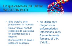 En que casos es útil  utilizar 
WESTERN BLOT
• Si la proteína esta 
presente en mi muestra 
• Como varia el nivel de 
expresi