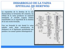 La exposición de la dentina de la raíz
desencadena la formación del cemento, las
células de la vaina producen un material
sem