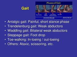 Gait
• Antalgic gait: Painful, short stance phase
• Trendelenburg gait: Weak abductors
• Waddling gait: Bilateral weak abduct