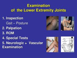 Examination
of  the Lower Extremity Joints
1. Inspection 
Gait – Posture
2. Palpation
3. ROM
4. Special Tests
5. Neurologic +