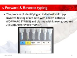 Gel Card Method in Blood Grouping | PDF