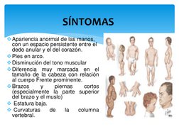 Apariencia anormal de las manos, 
con un espacio persistente entre el 
dedo anular y el del corazón.
Pies en arco.
Disminu