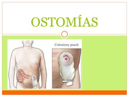 OSTOMÍAS
