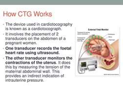 How CTG Works
• The device used in cardiotocography
is known as a cardiotocograph. 
• It involves the placement of 2 
transdu