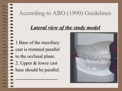 According to ABO (1990) Guidelines
           Lateral view of the study model
1.Base of the maxillary 
cast is trimmed parall