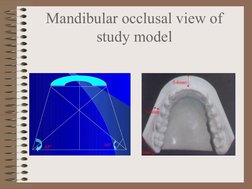 Mandibular occlusal view of 
study model
