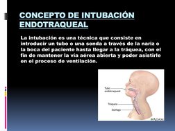 CONCEPTO DE INTUBACIÓN 
ENDOTRAQUEAL
La intubación es una técnica que consiste en 
introducir un tubo o una sonda a través de