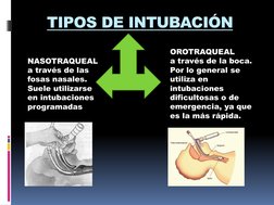 TIPOS DE INTUBACIÓN
NASOTRAQUEAL
a través de las 
fosas nasales. 
Suele utilizarse 
en intubaciones 
programadas
OROTRAQUEAL