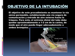 OBJETIVO DE LA INTUBACIÓN
El objetivo de este procedimiento es mantener la vía 
aérea permeable, estableciendo una vía segura