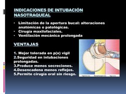 INDICACIONES DE INTUBACIÓN 
NASOTRAQUEAL
•
Limitación de la apertura bucal: alteraciones 
anatómicas o patológicas.
•
Cirugía