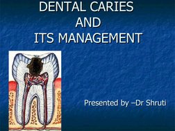 Overview of Dental Caries Management | PDF | Human Tooth | Tooth Enamel