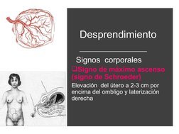 Desprendimiento 
  Signos  corporales 
Signo de máximo ascenso 
(signo de Schroeder)
Elevación  del útero a 2-3 cm por 
enci