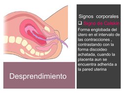 Desprendimiento
 Signos  corporales 
 Signo de Calskin 
Forma englobada del 
útero en el intervalo de 
las contracciones ,