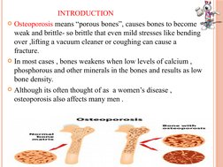 INTRODUCTION
Osteoporosis means “porous bones”, causes bones to become 
weak and brittle- so brit