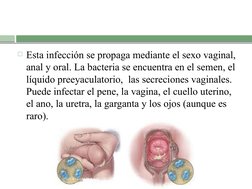 Esta infección se propaga mediante el sexo vaginal, 
anal y oral. La bacteria se encuentra en el semen, el 
líquido preeyacu