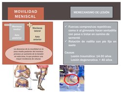 MOVILIDAD 
MENISCAL 
Meniscos 
lateral
Asta 
anterior
Meniscos 
medial
Asta 
posterior
La descenso de la movilidad en la 
zon
