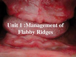 Management of Flabby Ridges in Dentures | PDF | Dentures | Dentistry ...