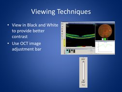OCT Imaging: Reading and Pathology Guide | PDF | Retina | Optics
