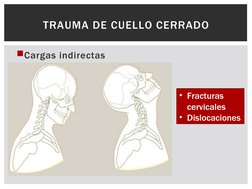 Cargas indirectas 
TRAUMA DE CUELLO CERRADO
• Fracturas 
cervicales
• Dislocaciones 
