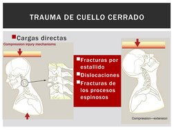 Cargas directas 
TRAUMA DE CUELLO CERRADO
Fracturas por 
estallido 
Dislocaciones
Fracturas de 
los procesos 
espinosos
