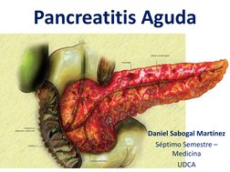 Pancreatitis Aguda
Daniel Sabogal Martínez
Séptimo Semestre –
Medicina 
UDCA
