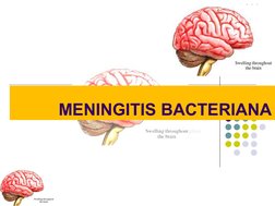 MENINGITIS BACTERIANA
