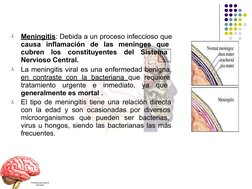 
Meningitis: Debida a un proceso infeccioso que  
causa inflamación de las meninges que  
cubren los constituyentes del Sist