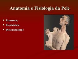 Anatomia e Fisiologia da Pele
Anatomia e Fisiologia da Pele
Espessura;
Espessura;
Elasticidade
Elasticidade
Distensibilida