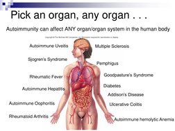 Pick an organ, any organ . . .
Autoimmunity can affect ANY organ/organ system in the human body
Pemphigus
Multiple Sclerosis