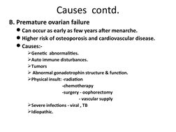 Causes  contd.
B. Premature ovarian failure 
Can occur as early as few years after menarche.
Higher risk of osteoporosis an