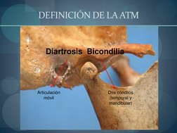  
DEFINICIÓN DE LA ATM 
Diartrosis  Bicondilia 
 
Articulación 
móvil 
Dos cóndilos 
(temporal y 
mandibular) 

