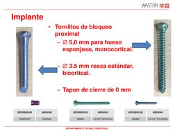 Implante
• Tornillos de bloqueo
proximal
– 5,0 mm para hueso
esponjoso, monocortical.
– 3.5 mm rosca estándar, 
bicortical.
