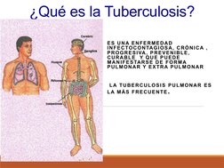 ¿Qué es la Tuberculosis?
ES UNA ENFERMEDAD 
INFECTOCONTAGIOSA, CRÓNICA , 
PROGRESIVA, PREVENIBLE, 
CURABLE  Y QUE PUEDE 
MANI