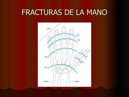 FRACTURAS DE LA MANO
FRACTURAS DE LA MANO
