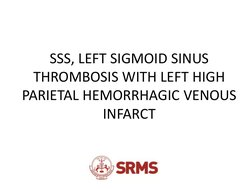 Sss Infarction Radiology Spotters Overview and Cases | PDF | Science & Mathematics