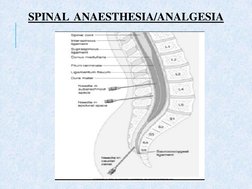 SPINAL  ANAESTHESIA/ANALGESIA 
  
