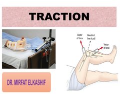 Types and Principles of Traction | PDF | Surgery | Skeletal Muscle