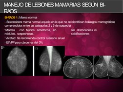 Clasificación BI-RADS 2 en Mamografía | PDF | Mamografía | Cáncer de mama