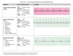 ECG Interpretation for ACLS Training | PDF | Electrocardiography ...