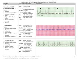 ECG Interpretation for ACLS Training | PDF | Electrocardiography ...