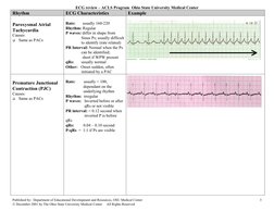 ECG Interpretation for ACLS Training | PDF | Electrocardiography ...